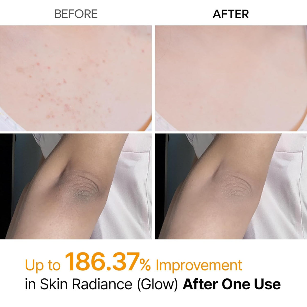 Dr.Melaxin - Peel Shot Kojic Acid Spray