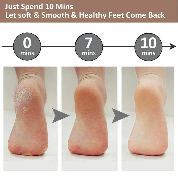 ELECTRIC PEDI CALLUS REMOVER