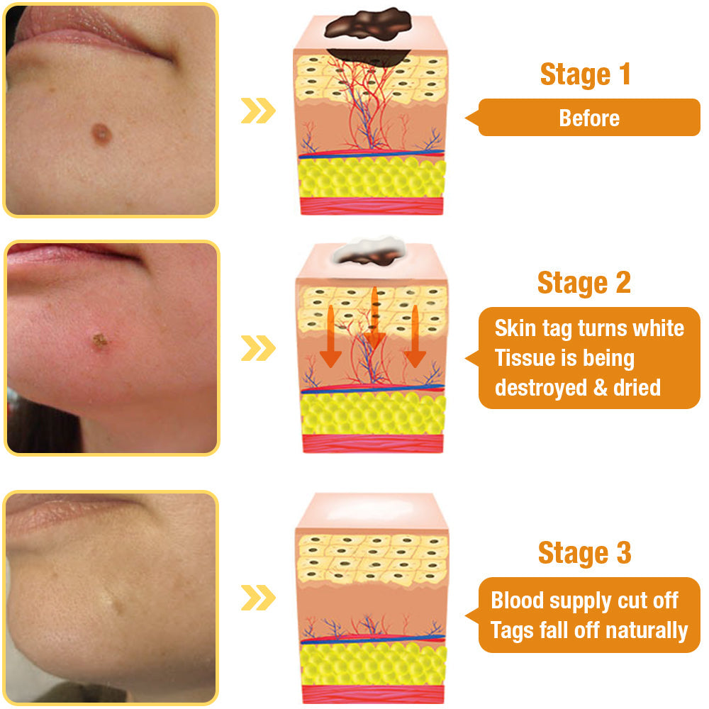 Tagrecede Bees Treatment Spray